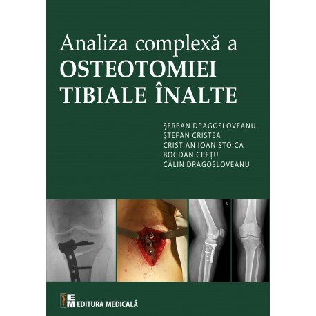 Analiza complexă a osteotomiei tibiale înalte - Ș. Dragosloveanu, Ș. Cristea, C. Ioan Stoica, B. Crețu, C. Dragosloveanu