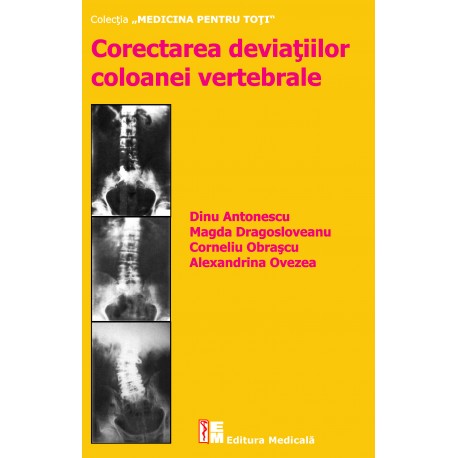 Corectarea deviatiilor coloanei vertebrale – editia a II-a - D. Antonescu, M. Dragosloveanu, C. Obrascu, A. Ovezea